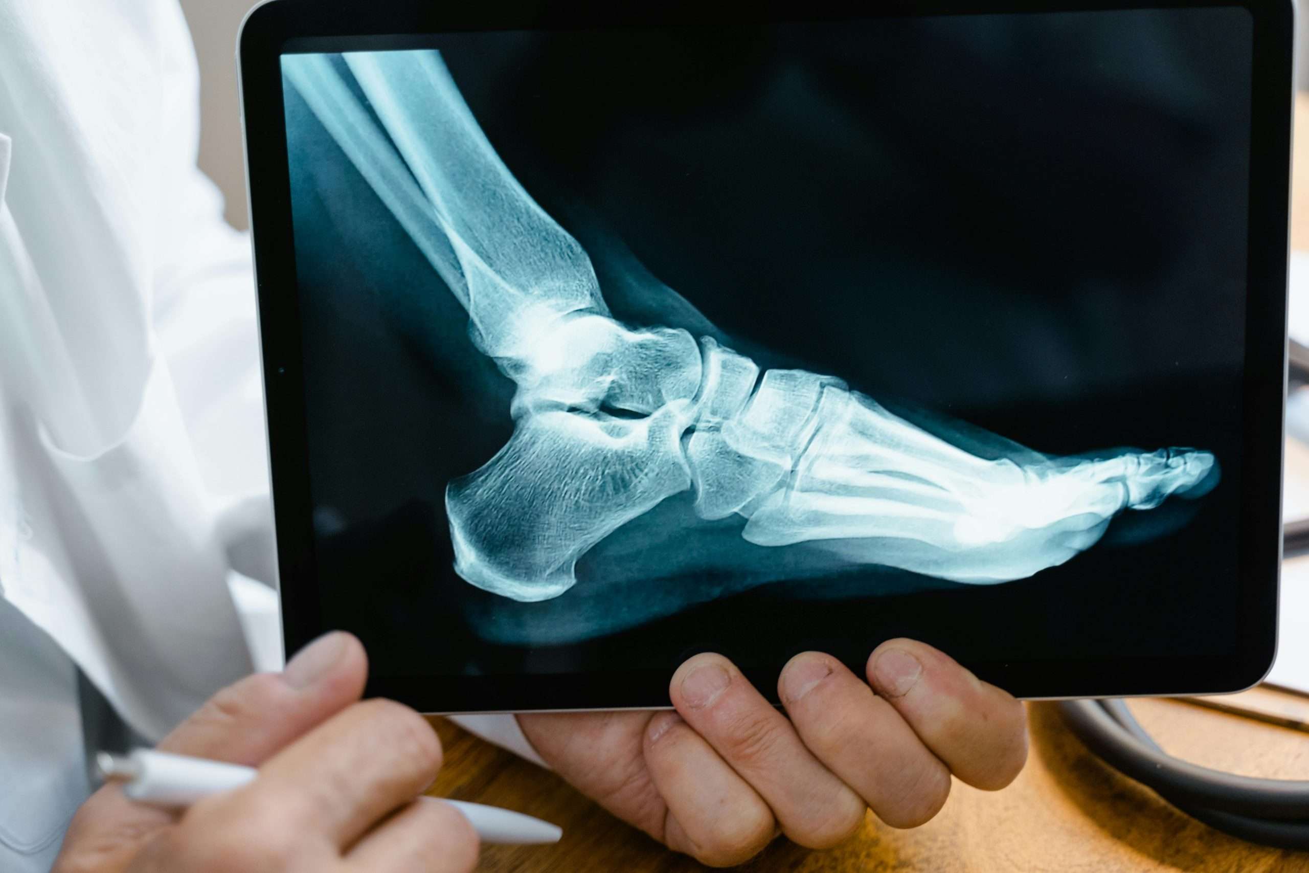 reconstructive foot surgery