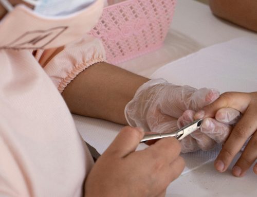 The Real Cost of Laser Toenail Fungus Treatment (And Whether It’s Worth It)