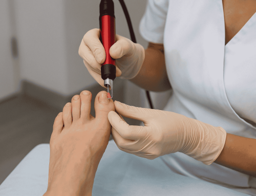 Is There a Fast Fix for Toenail Fungus? Here’s What Actually Works