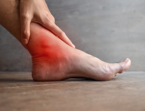 Sprained Foot vs. Broken Foot: Key Differences & Signs