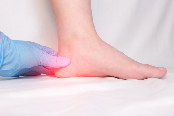 A podiatrist in blue gloves performing a physical examination by palpating a patient's heel to confirm a clinical diagnosis of plantar fasciitis.